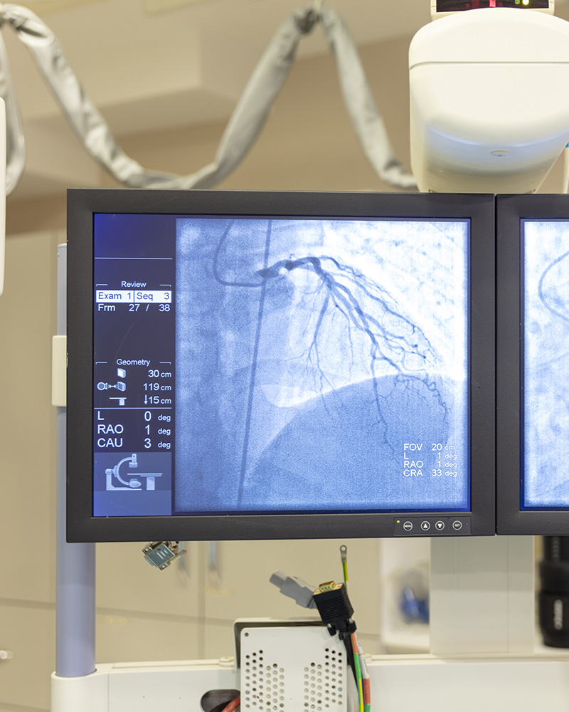 Cardiac Ablation Cardiac Services St Vincent's Private Hospitals