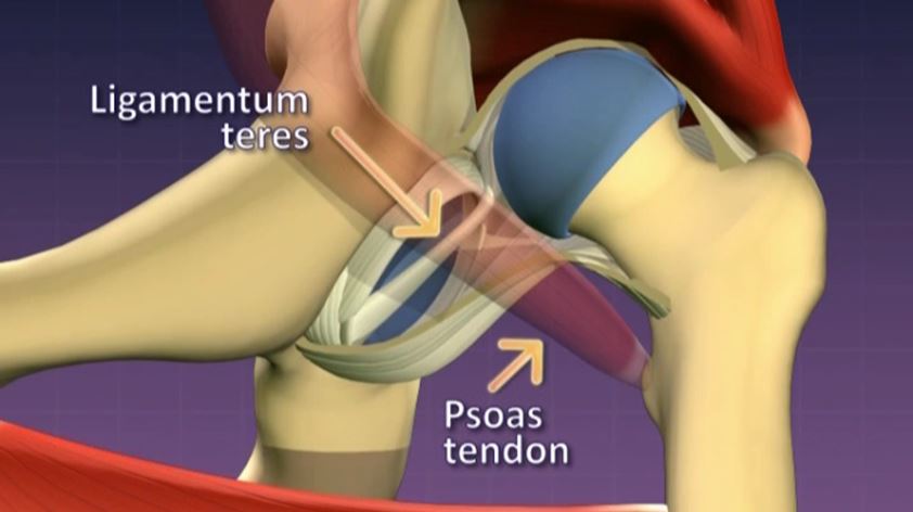 Anatomy of a dislocated hip