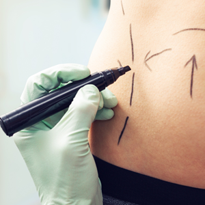 Body Contouring
