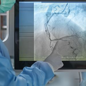 Coronary Artery Disease