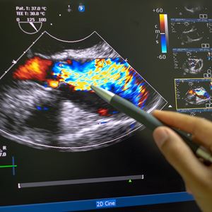 Heart Valve Disease