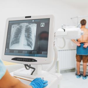 Chest x-ray