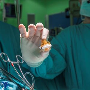 Aortic Valve Replacement