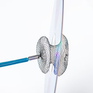 Atrial Septal Defect Closures