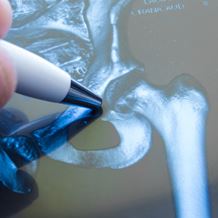 orthopaedics hip surgeries conditions diagram illustrated