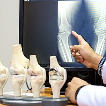 orthopaedics knee replacement