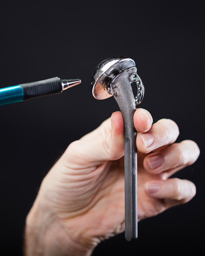 orthopaedics Shoulder replacement total