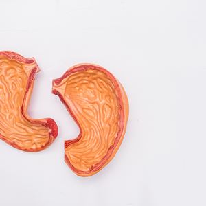 What is bariatric surgery?