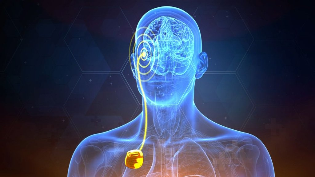 Electrodes connected to a battery device implanted in the chest